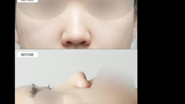 동영상