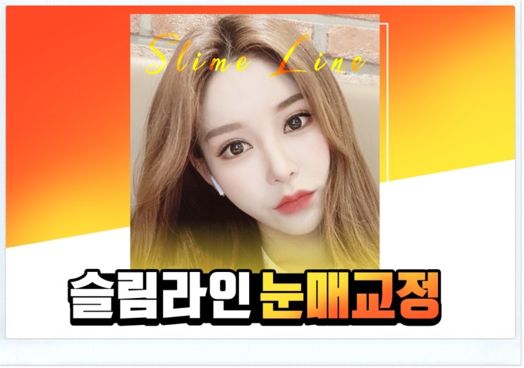 눈매교정비용 궁금하다면 이렇게 해보세요.