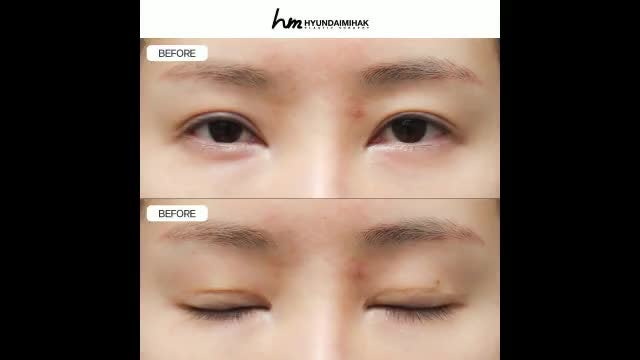 동영상