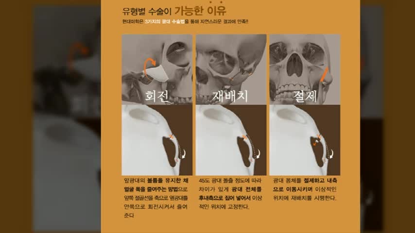 동영상