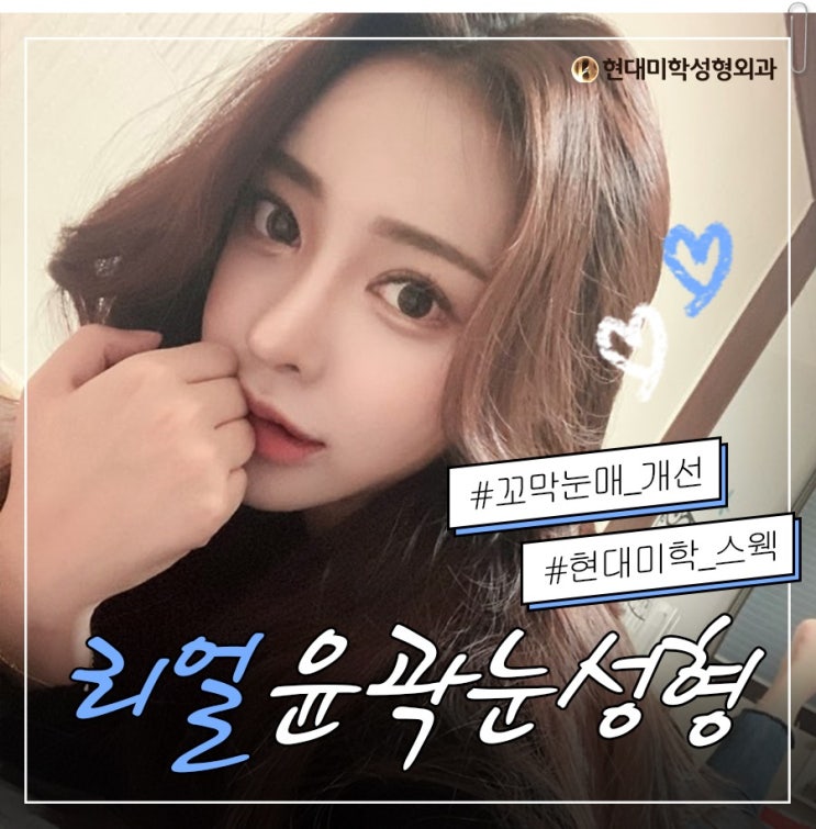 안검하수병원 어디일까?