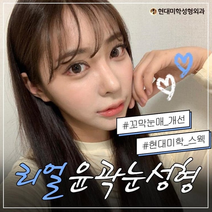 강남뒤트임 예쁘고 난리야