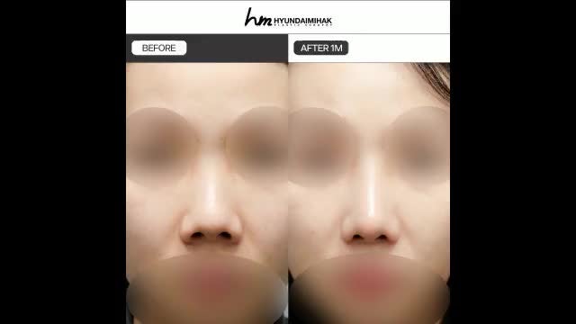 동영상