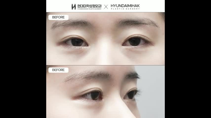동영상