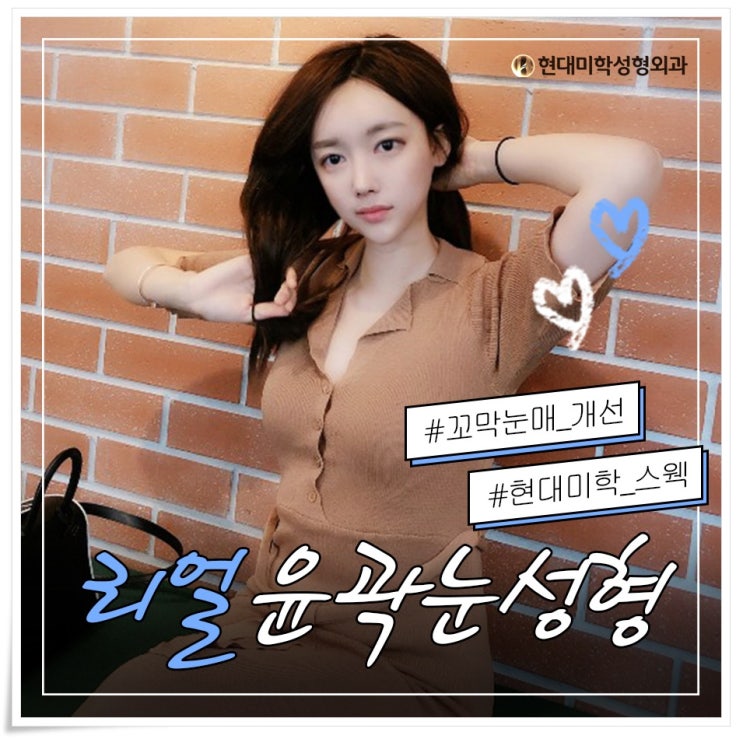 눈밑지방재배치수술후 예뻐졌다