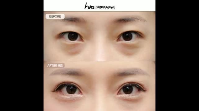 동영상