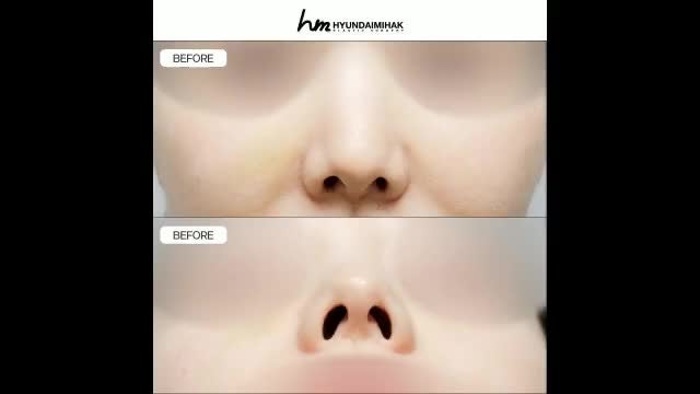 동영상