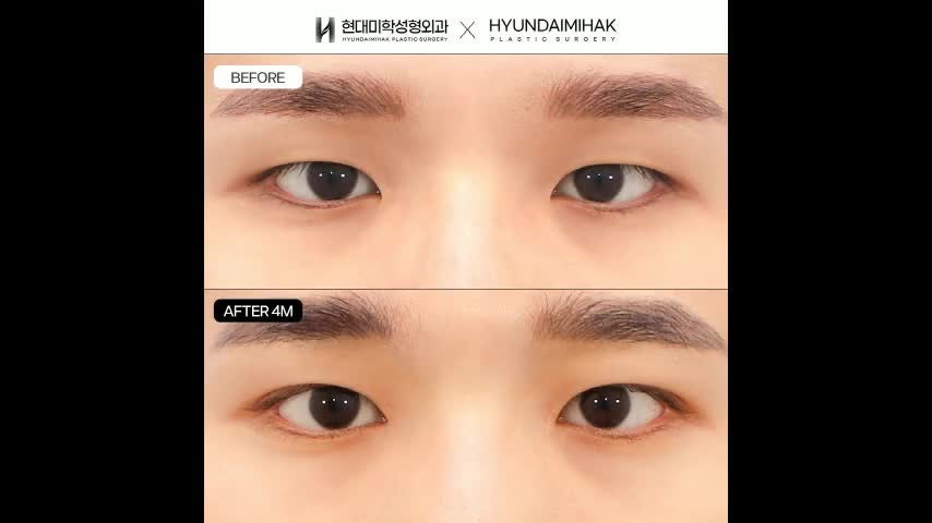 동영상