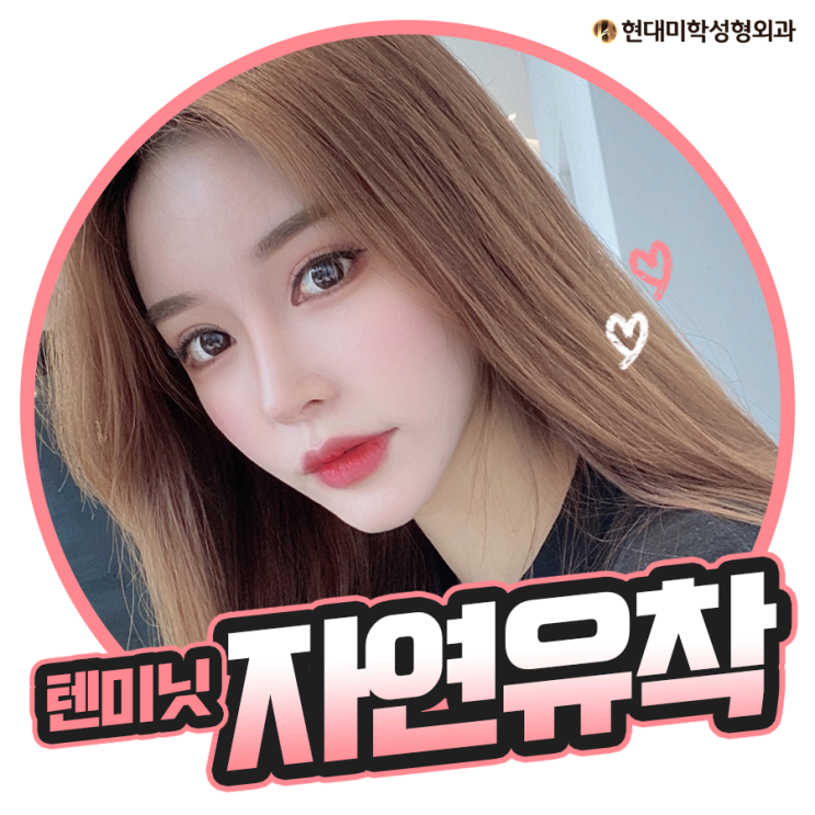 쌍꺼풀자연유착 자연스러움에 깜놀