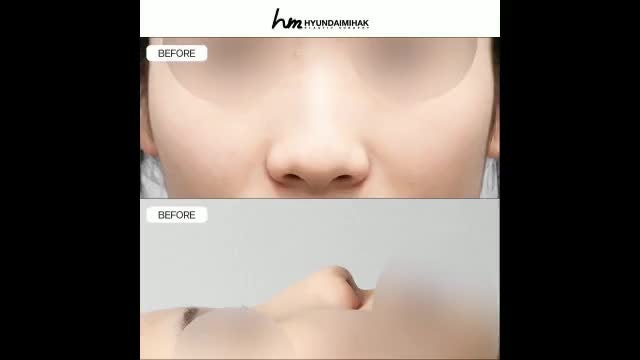 동영상