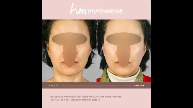 동영상