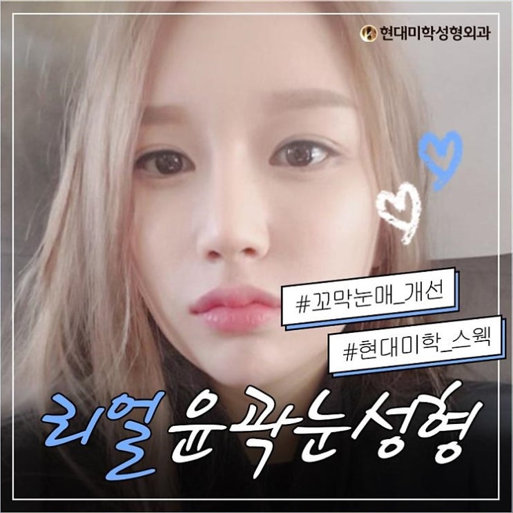 몽고주름 초롱초롱 돋보이네