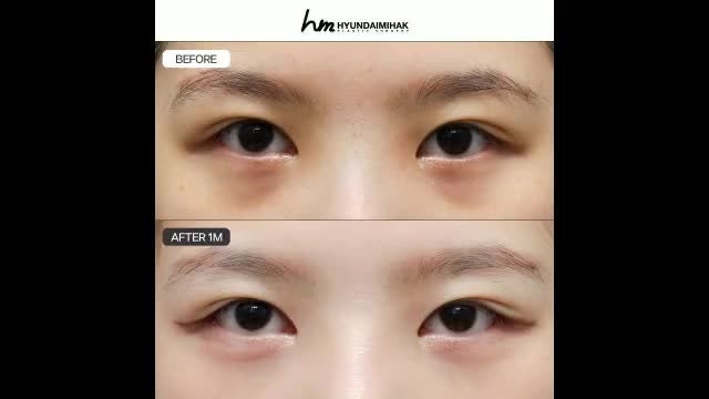 동영상