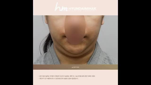 동영상