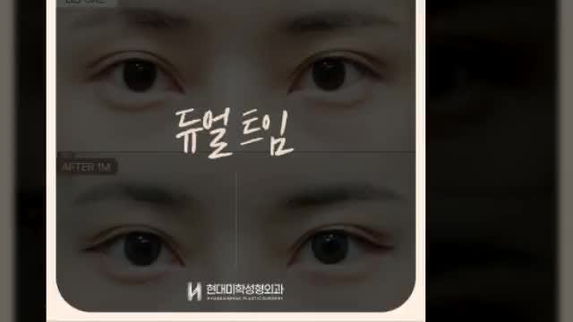 동영상