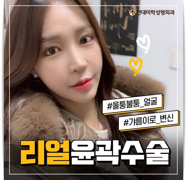 광대 고민이 많아?