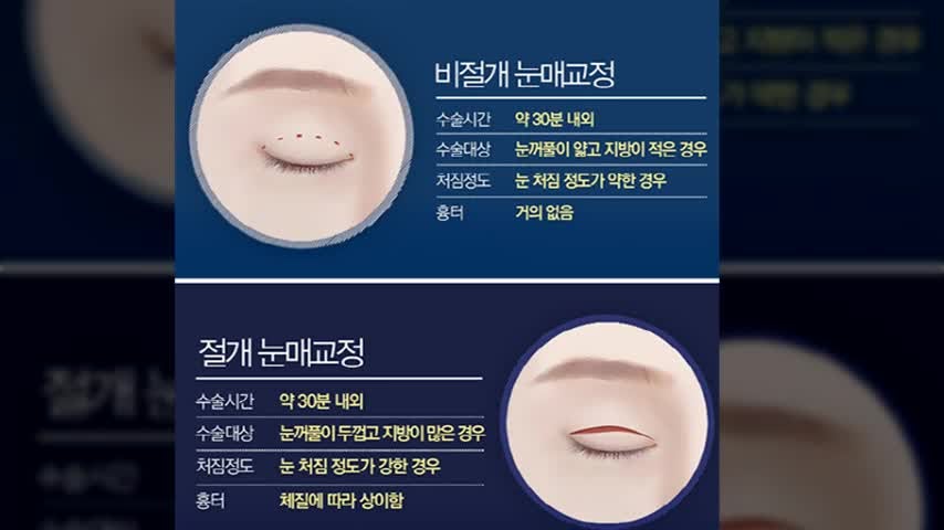 동영상