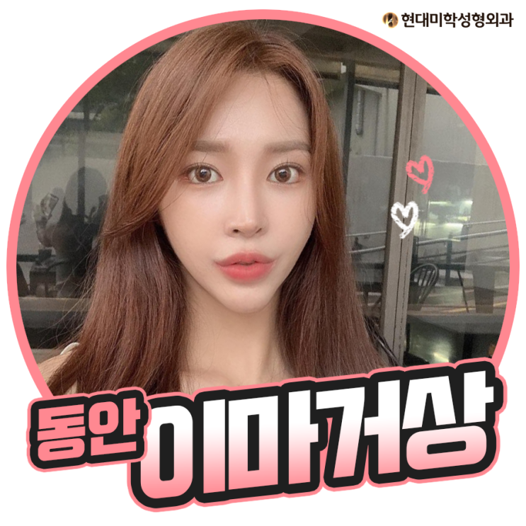 이마거상술후기 확실히 달라져요