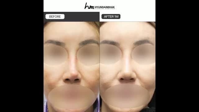 동영상