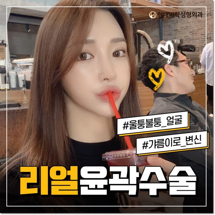 앞턱수술 느낌있게