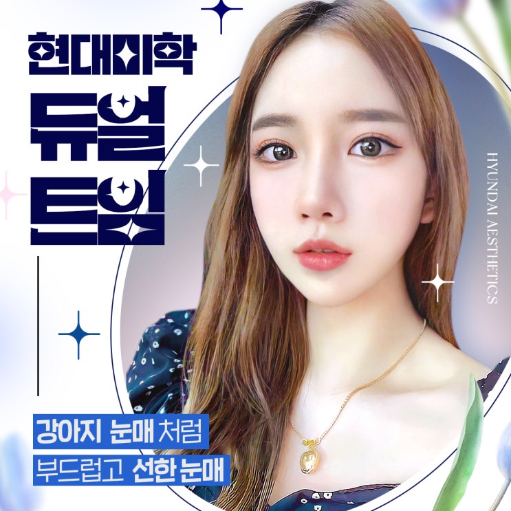 트임성형 이대로 괜찮을까요