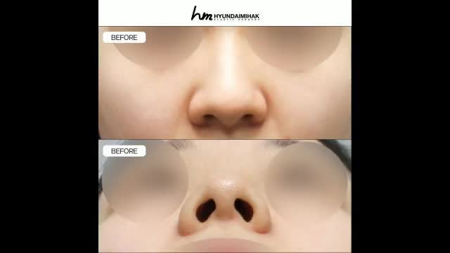 동영상