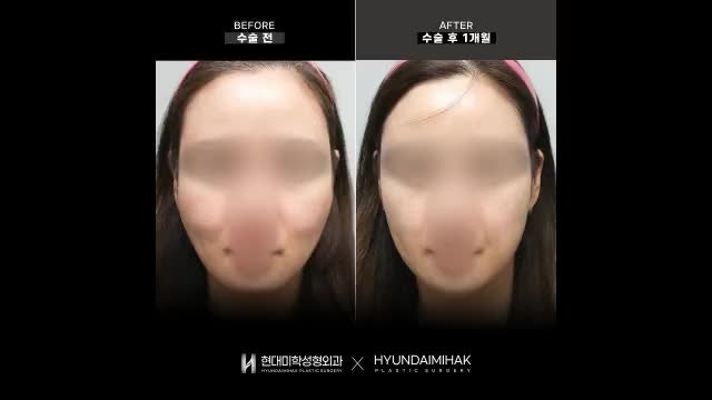 동영상