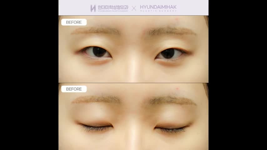 동영상
