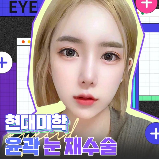 눈재수술비용 보다 중요한 이것