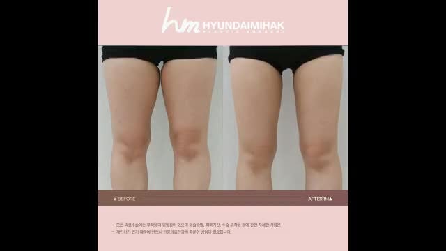 동영상