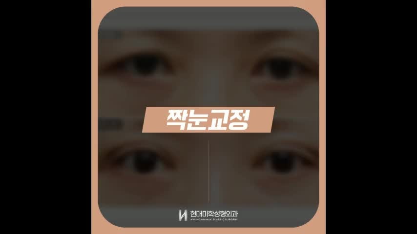 동영상
