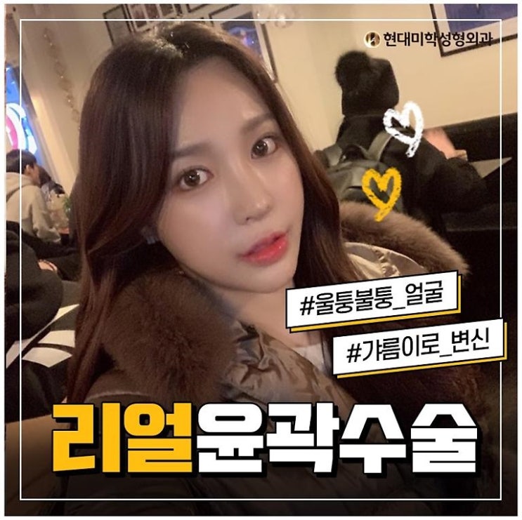 사각턱성형외과 리얼하게 예뻐지네