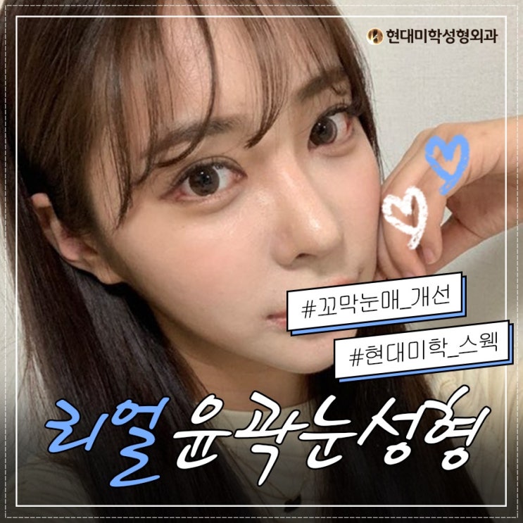 쌍수매몰후기 이렇게 좋아도 되나요?