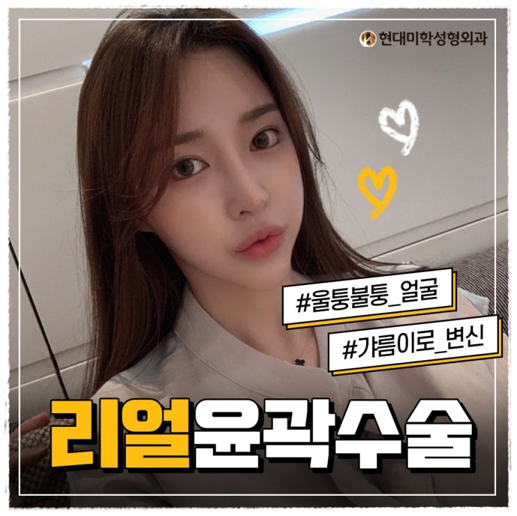 안면윤곽유명한병원 대박쓰한 라인