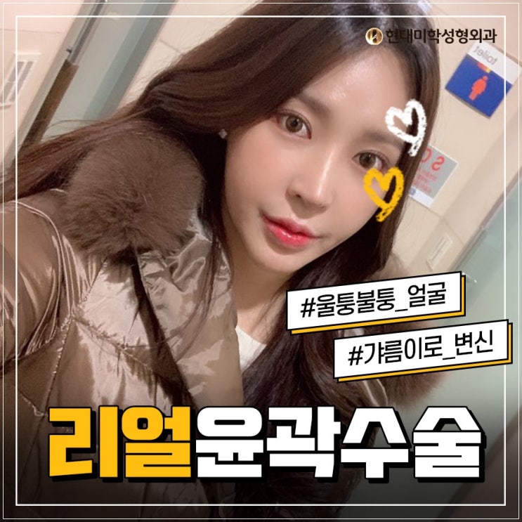 얼굴교정 대다네