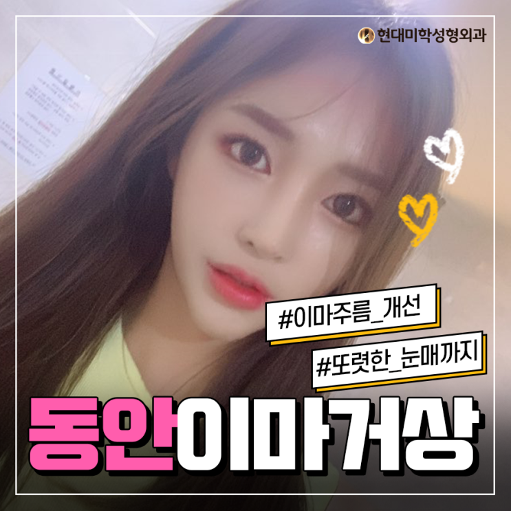 이마거상술가격 이렇게 좋을수가