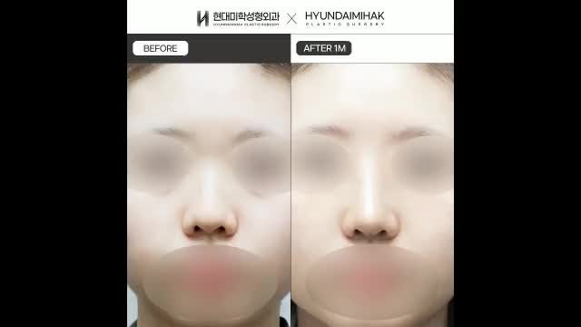동영상
