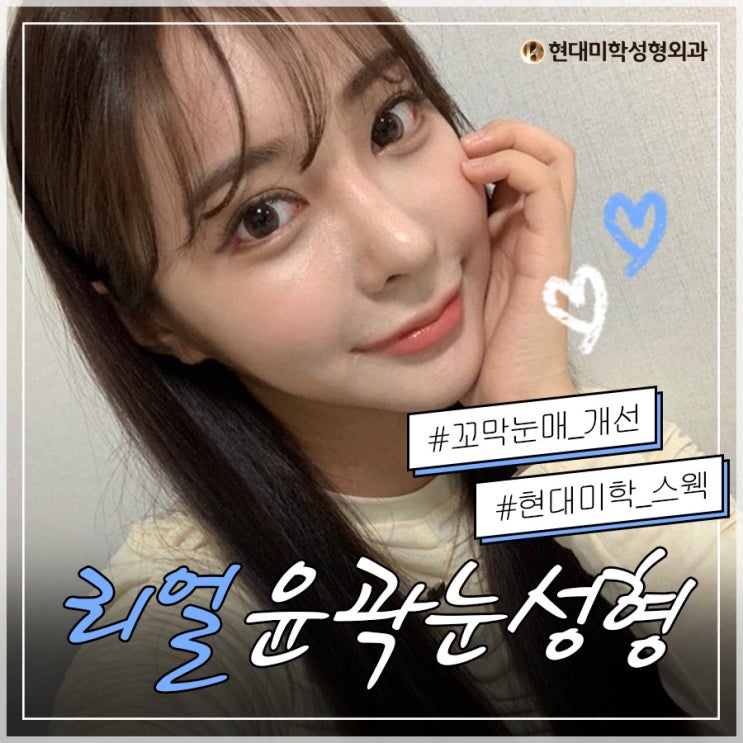 쌍꺼풀잘하는병원 예술적인 라인