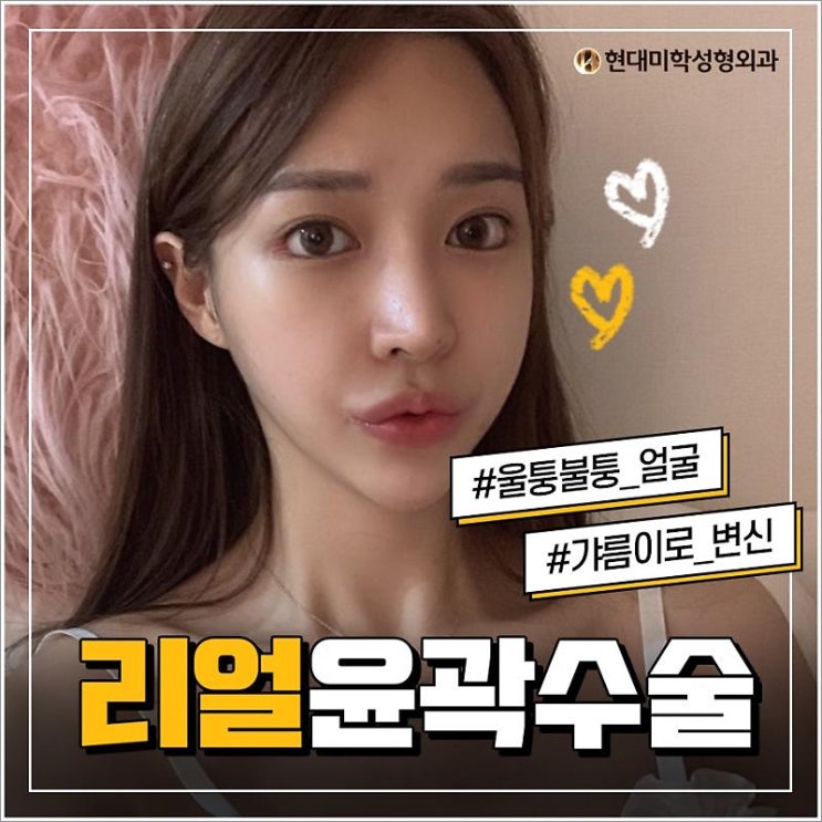 턱끝축소 매력 높이기 첫번째