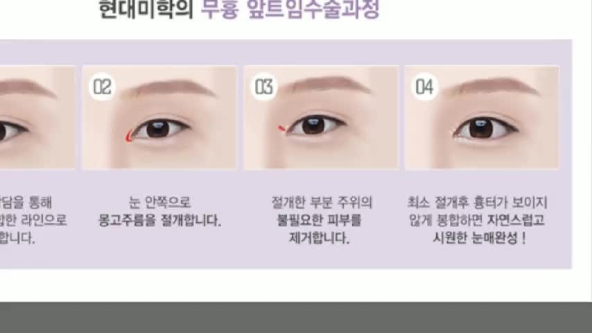 동영상