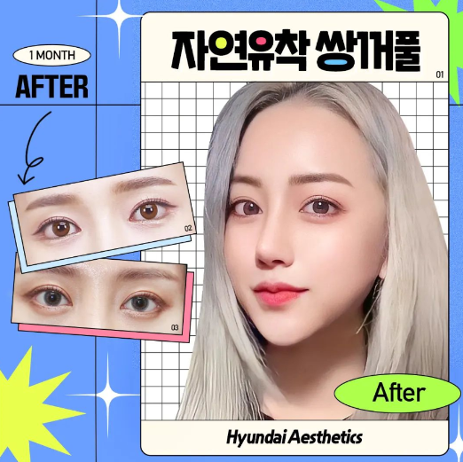 쌍수잘하는곳 알아볼 때 중요한 것