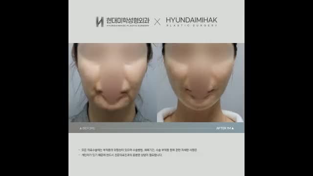 동영상