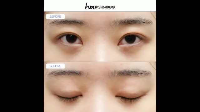 동영상