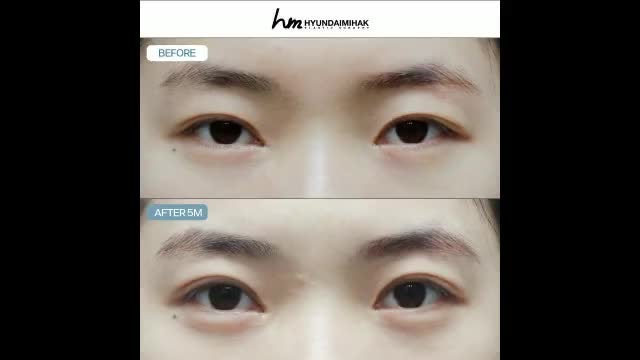 동영상