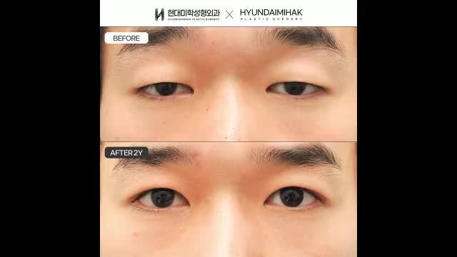 동영상