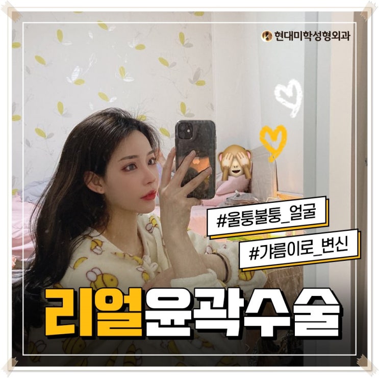 사각턱교정 살아나는 라인