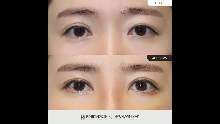 동영상