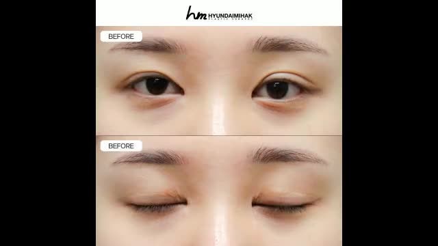 동영상