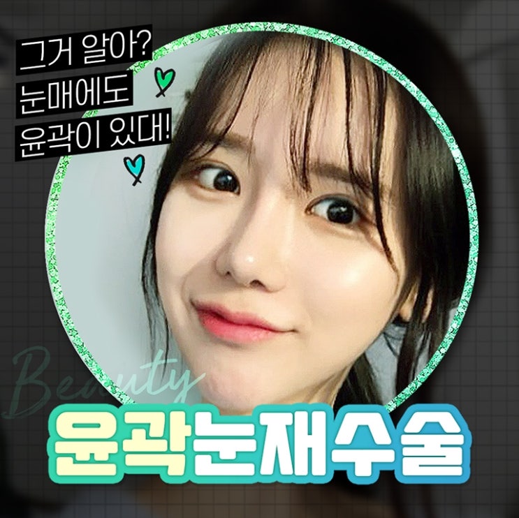 쌍꺼풀재수술잘하는병원 한번 보세요