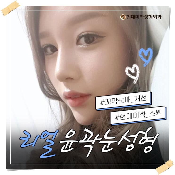 뒷밑트임후기 대박이자너